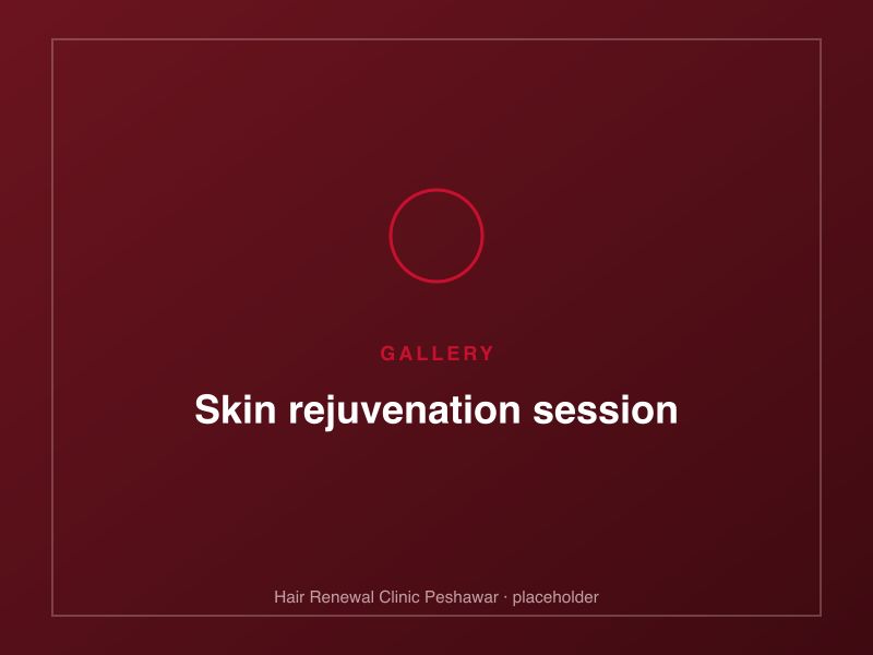 Microneedling treatment for skin texture