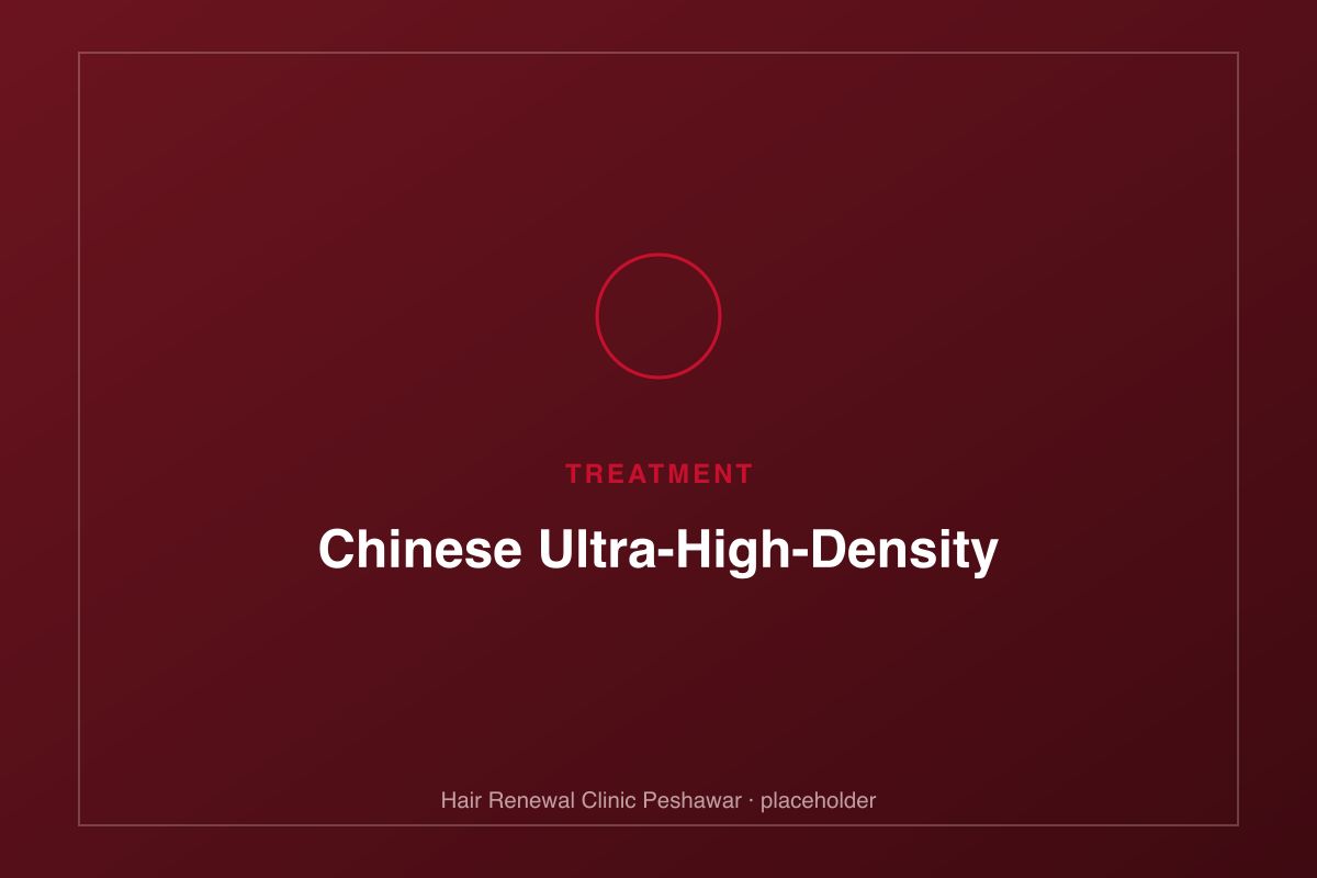 Close-up of high-density graft placement during the Chinese method