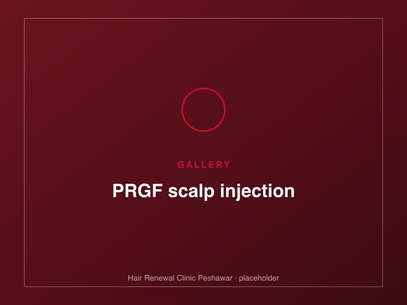 Growth-factor plasma drawn into a syringe